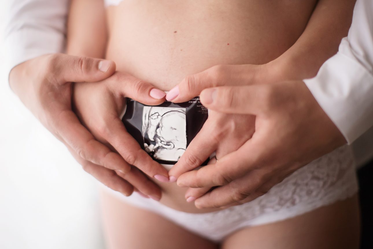 Bromley Maternity Photographer 21 Bromley Maternity Photoshoot | parents holding a baby scan photo